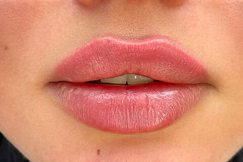 Lippen na