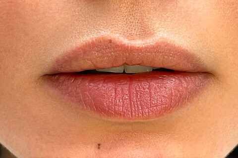 Lippen voor